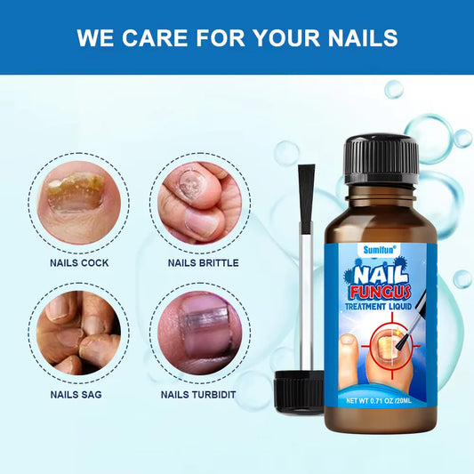 Sumifun Nail Fungus Treatment Liquid – Antifungal Nail Care for Toenails & Fingernails